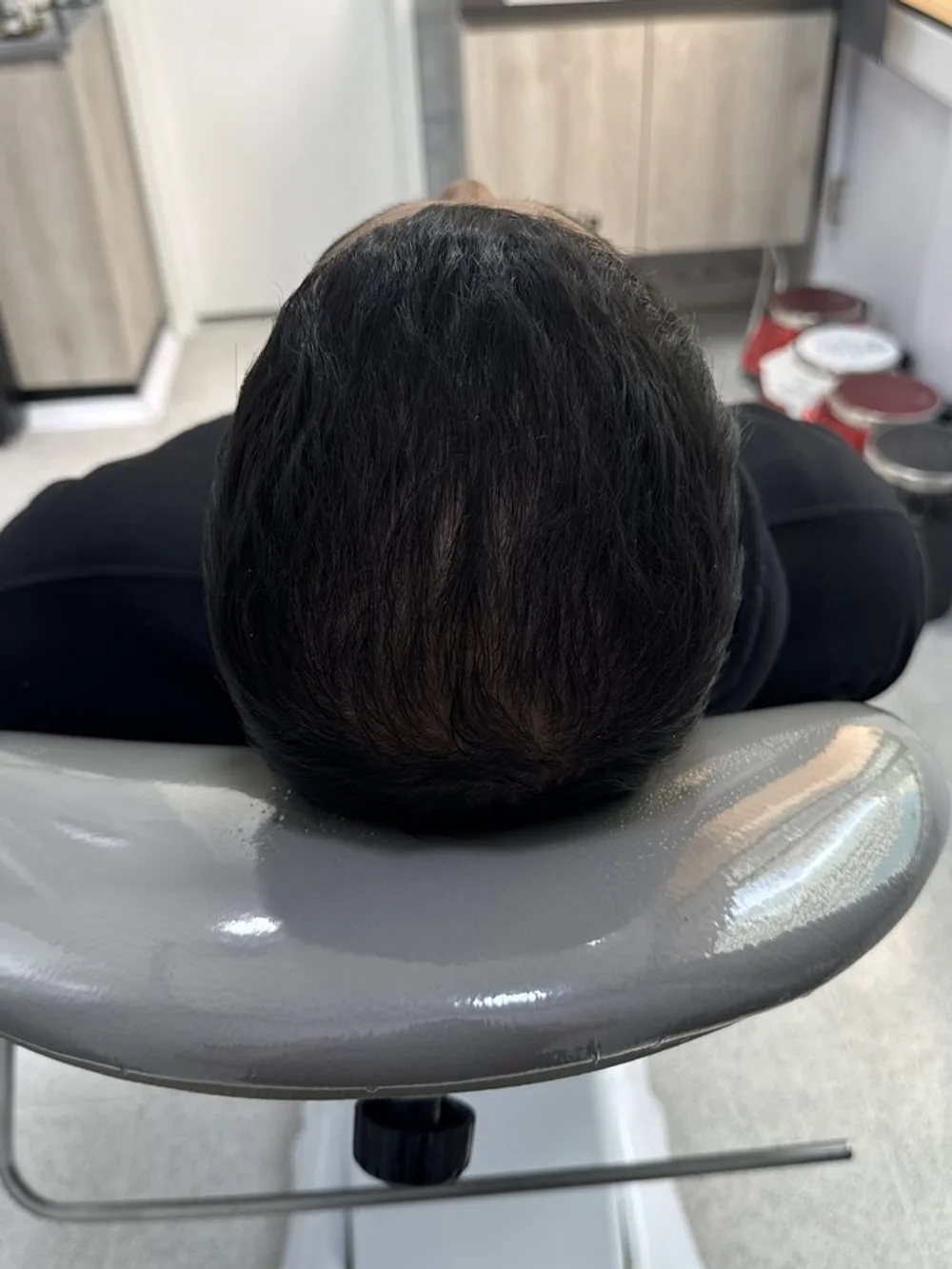 A denser crown: result