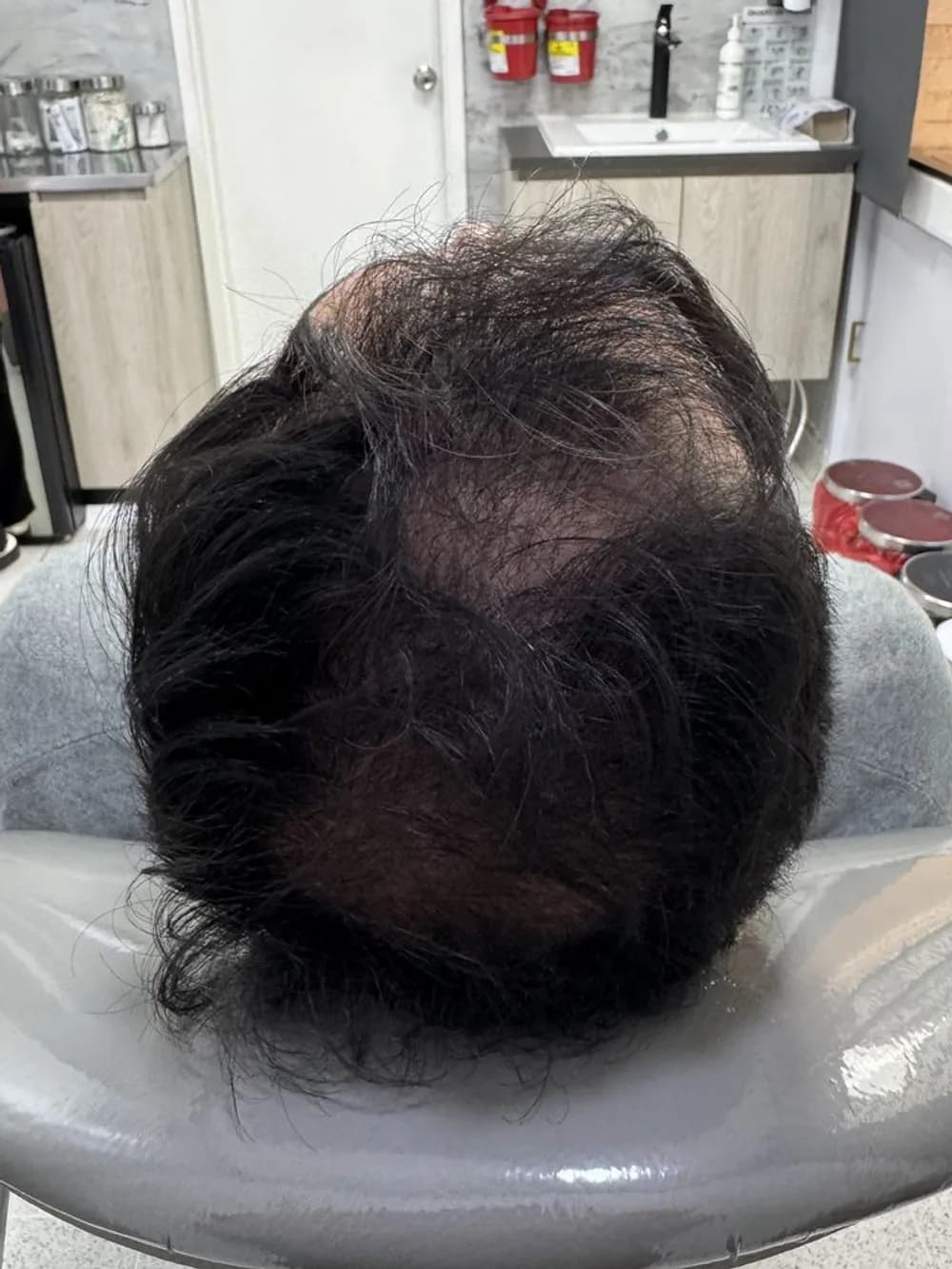 Coronilla más poblada: resultado