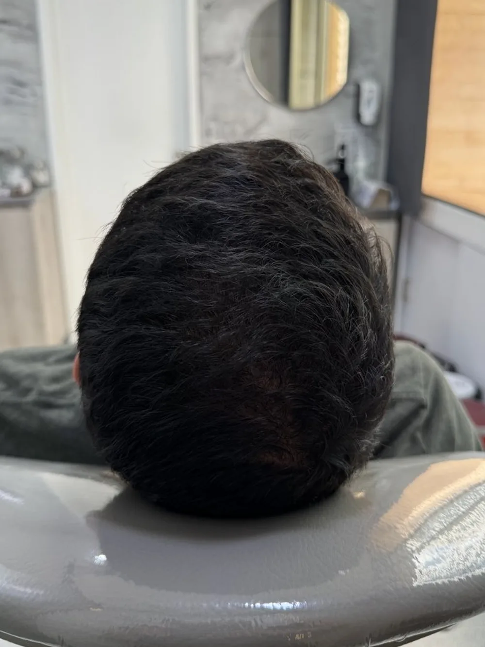 Cabello más denso en la parte superior: resultado