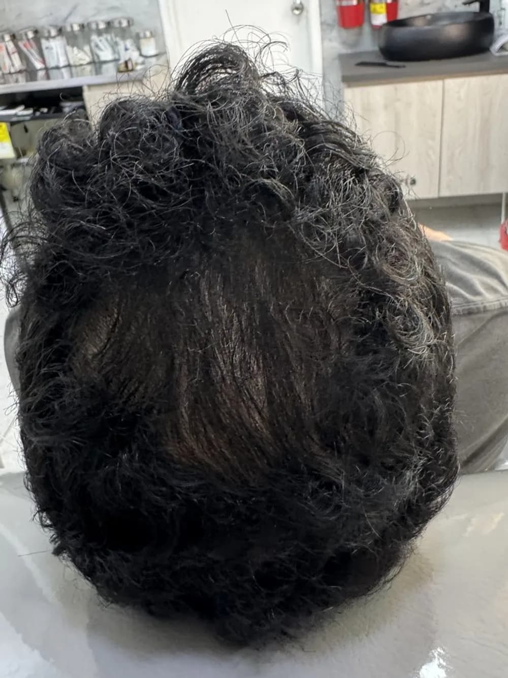 Del claro en la coronilla a un cabello abundante: después