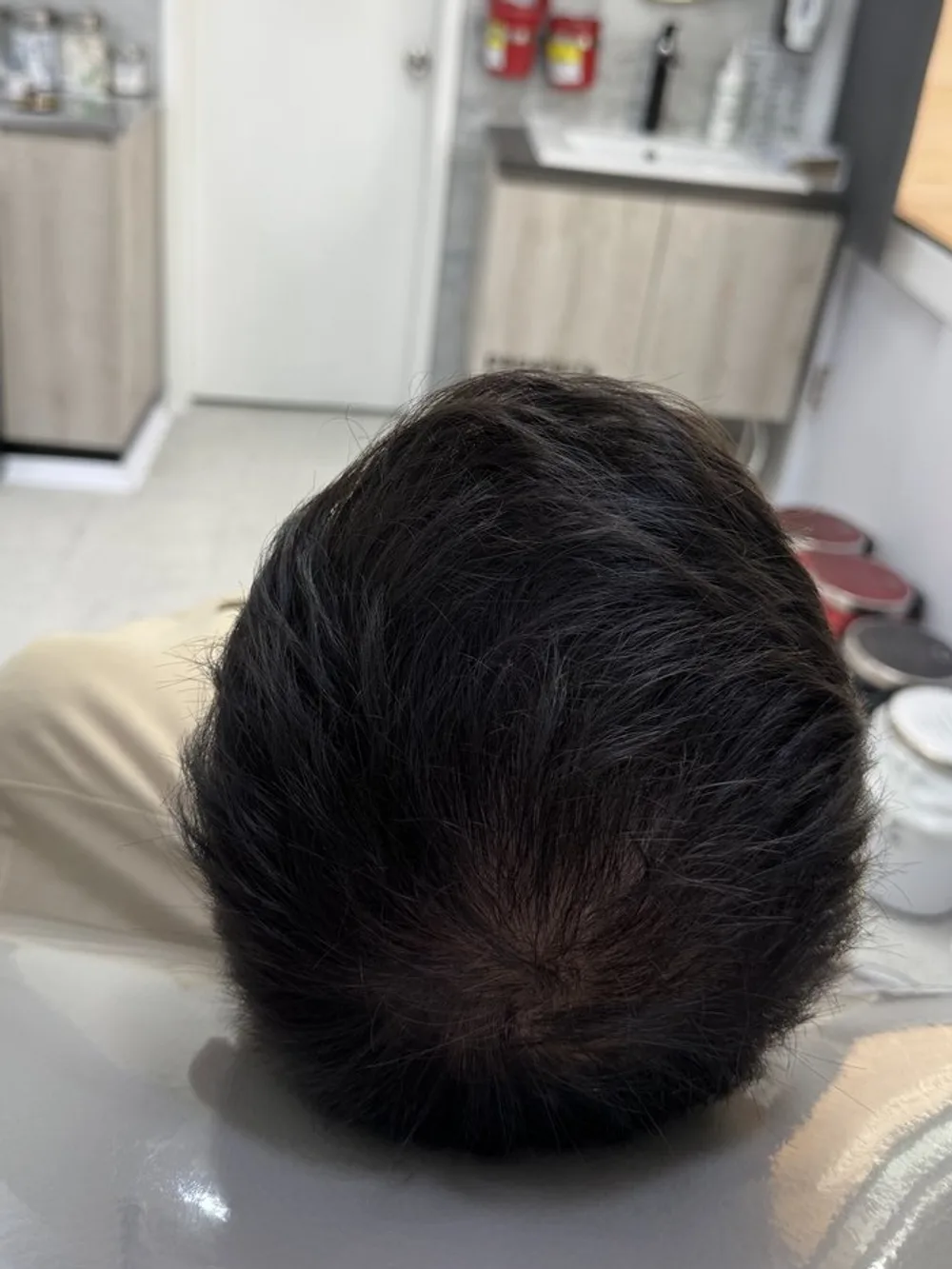 Coronilla sin claros: resultado