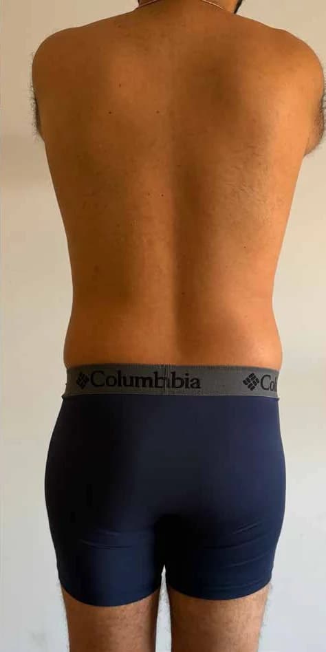 Back and flank contour: result
