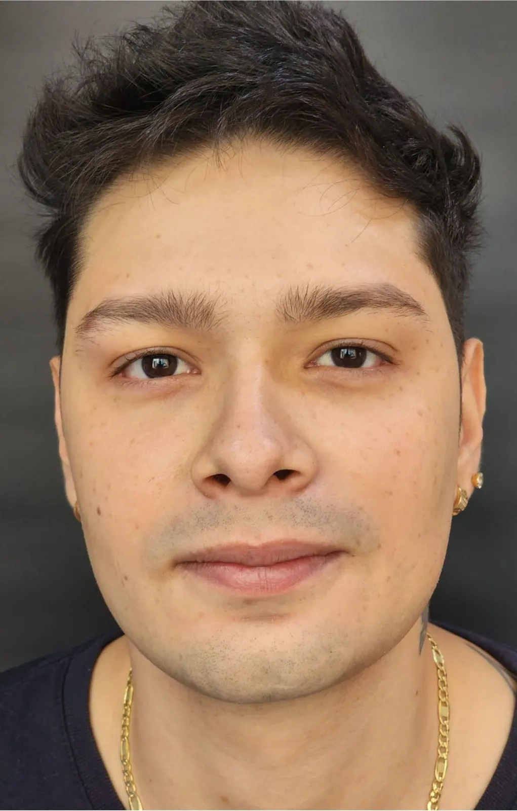 Contorno facial masculino · frente: antes