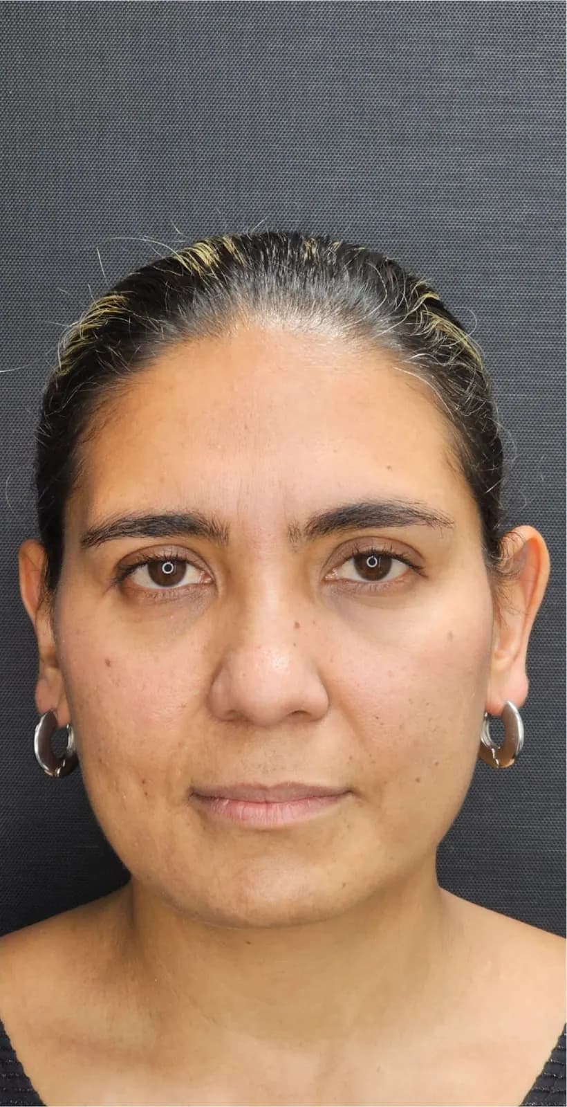 Long Lasting · frente: resultado